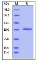 Human VSIG8, His Tag on SDS-PAGE under reducing (R) condition. The gel was stained overnight with Coomassie Blue. The purity of the protein is greater than 95%.